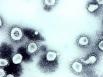 Coronavirus : la reconnaissance du cas de force majeure soulage la Ficime