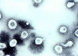 Coronavirus : la reconnaissance du cas de force majeure soulage la Ficime